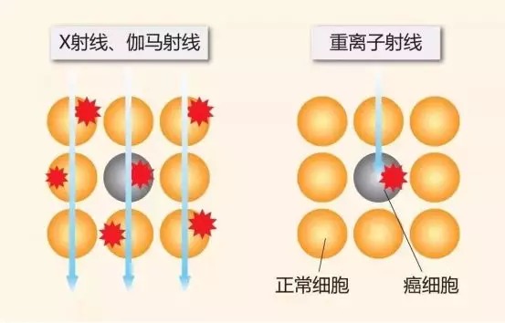 質(zhì)子重離子技術(shù)醫(yī)療險(xiǎn)可以報(bào)銷嗎？